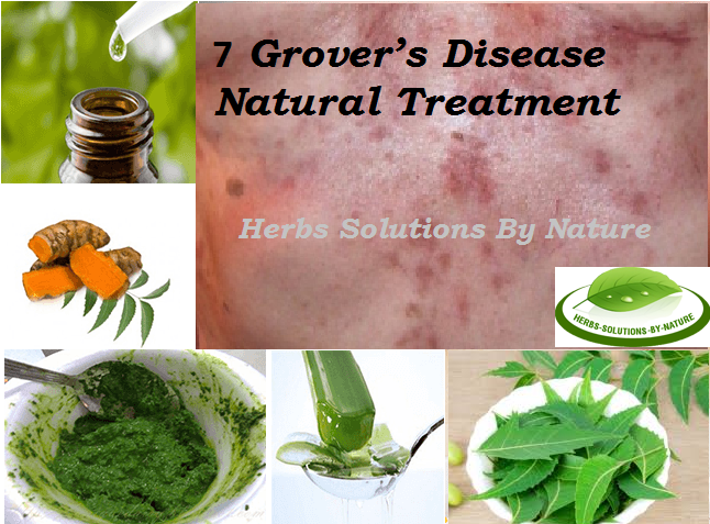 Ayurvedic Herbal Treatment Of Grover S Disease Transient Acantholytic Dermatosis In Adelaide Sa