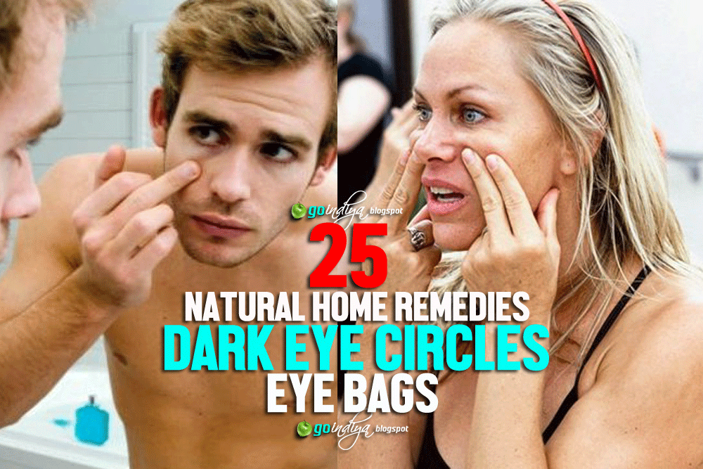 25 Home remedies for Dark Eye Circles and Puffy Eyes Part 2 Natural Home Remedies. Simple