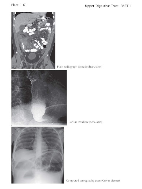 CROSS-SECTIONAL RADIOGRAPHIC IMAGING OF THE UPPER DIGESTIVE TRACT