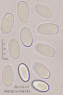 Cheilymenia theleboloides