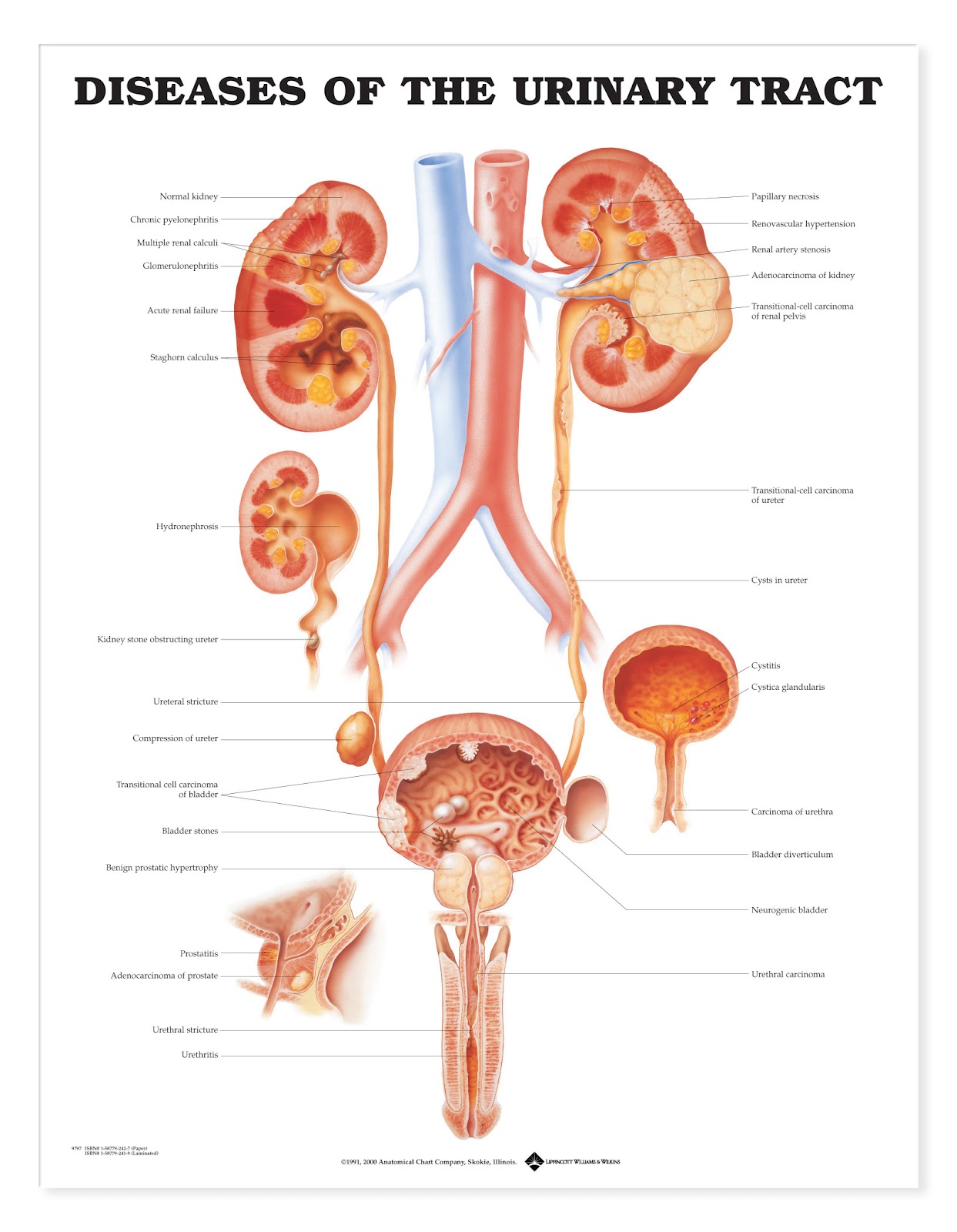 Diseases of genitourinary system ~ Urology Notes 2012