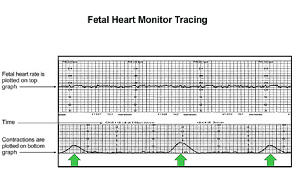 MBBS Medicine (Humanity First) Assessment of Fetal Wellbeing