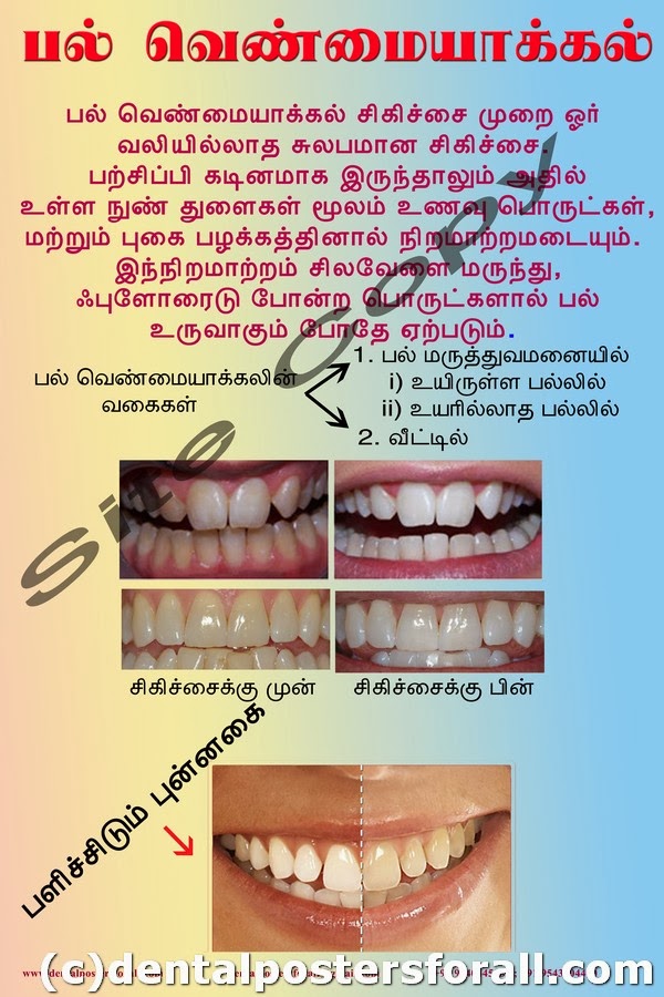 Dental Posters to Educate Patients