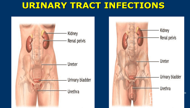 why urine infection happens again and again why urine infection happens again and again