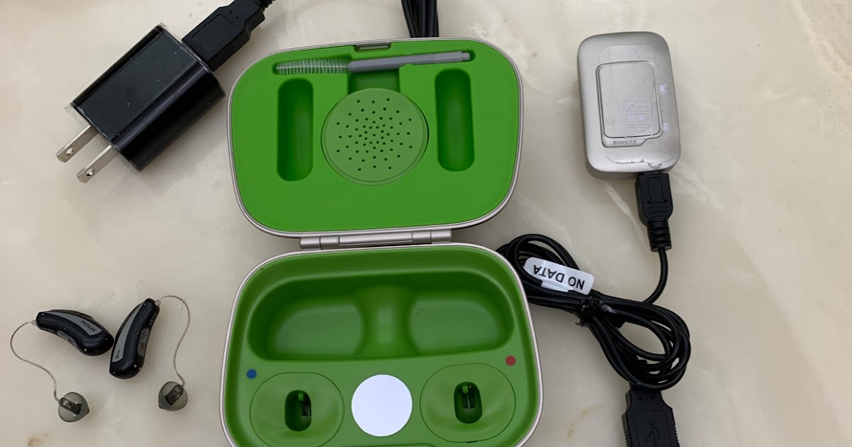 Views by the Bay Sounds Like a Racket