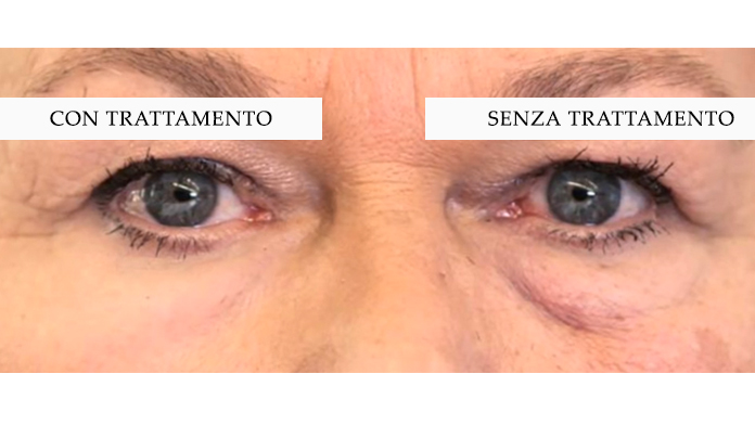 LA PELLE ARTIFICIALE [X] Gli utilizzatori della pelle artificiale