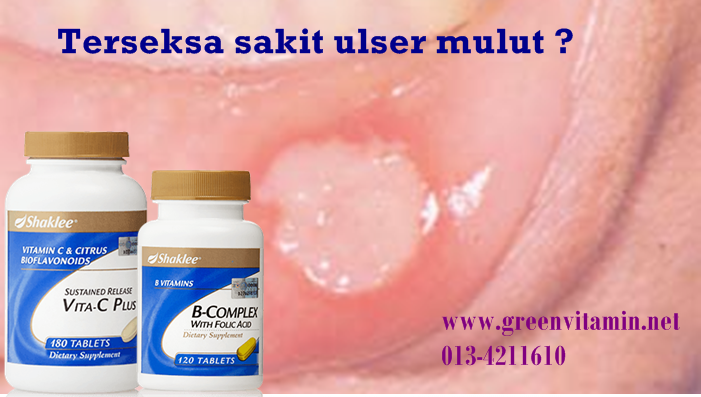 Cara Hilangkan Ulser Mulut  Cara Rawat Ulser Mulut Punca Langkah Yang