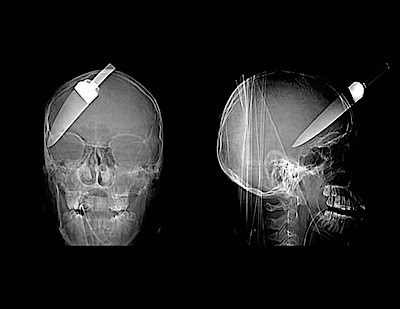 Radiografías raras