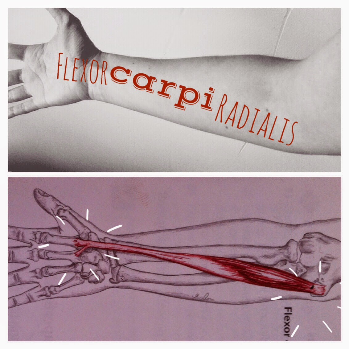 The Hip Joint: Flexor Carpi Radialis : a wrist flexor muscle