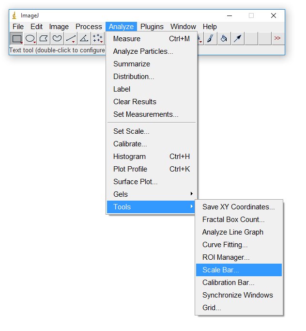 My imageJ Scale Bar เป็นการวาด Lable สำหรับเป็นแท่งเปรียบเทียบ scale ในภาพ