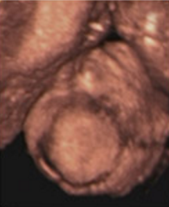 18 haftalık gebelik(hamilelik) ve bebeğin görüntüsü