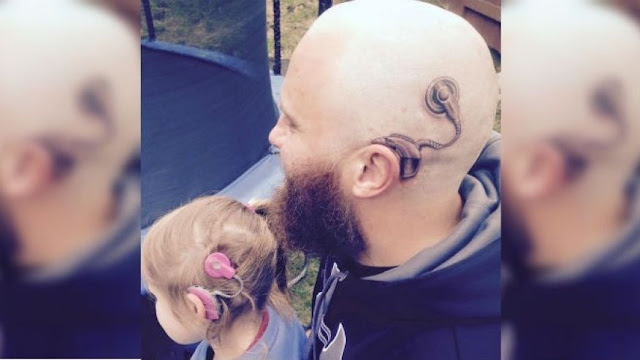 Father's cochlear implant Tattoo supporting deaf daughter who wears a Real Cochlear implant 
