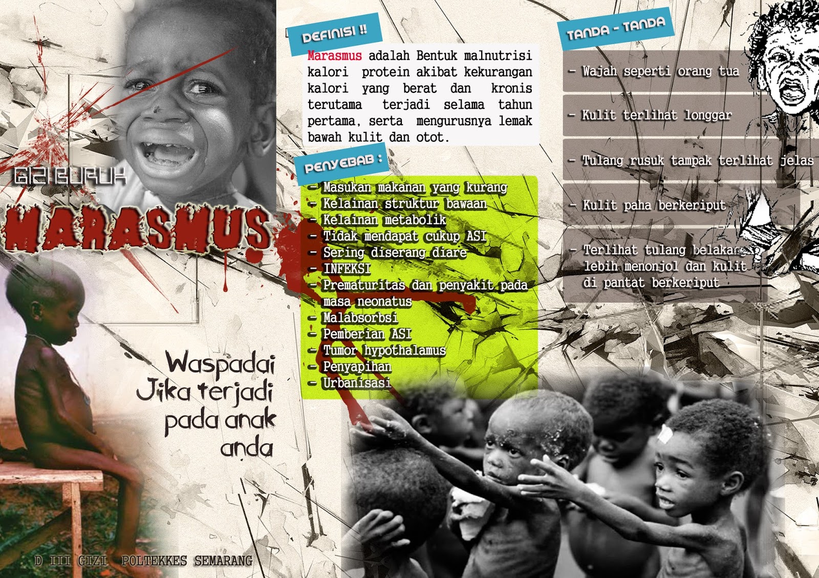 TEMBANG: Leaflet "Marasmus"