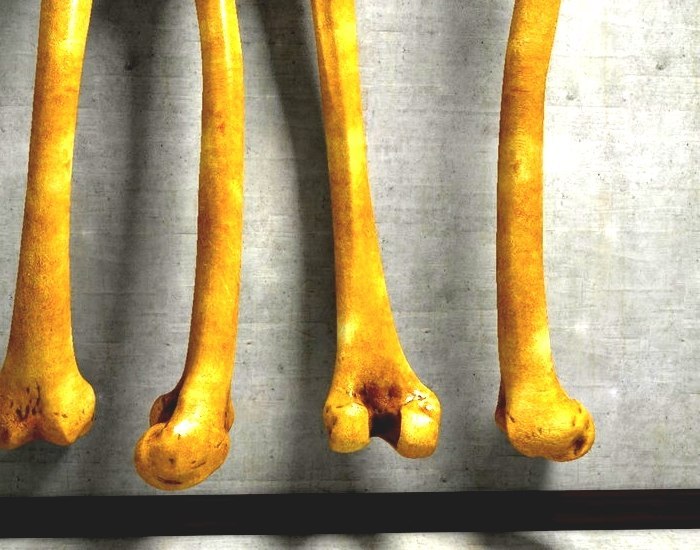 Femur - Human Femur Bone