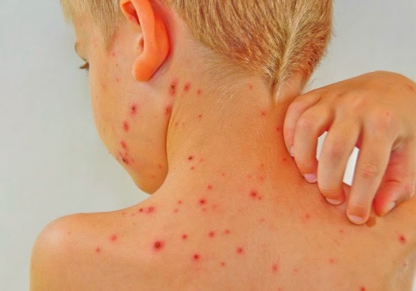 Natural At Home Beauty Remedies Natural At Home Beauty Remedies