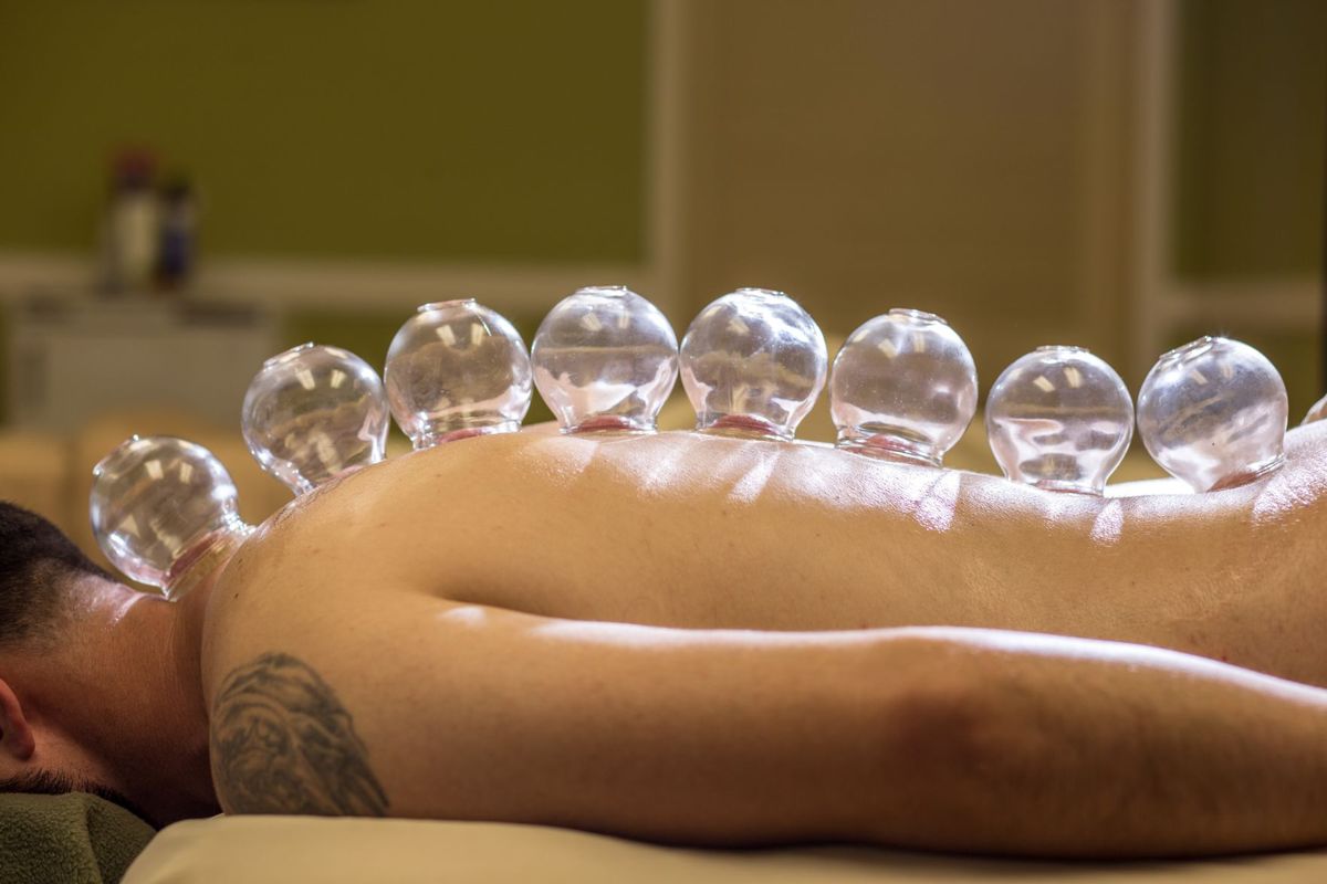 Cupping massage instrument. Емкости для каппинг терапии. Вакуумная терапия при импотенции.
