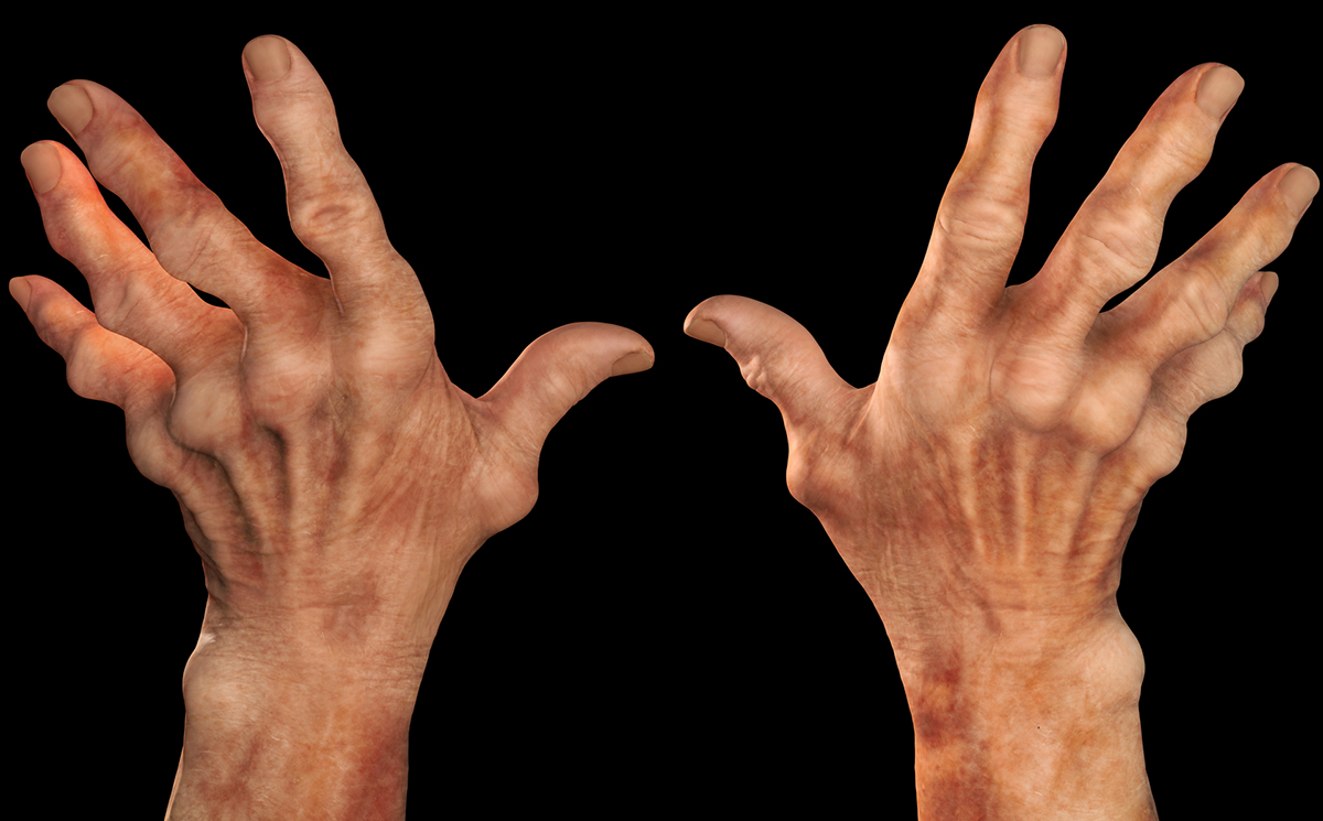 MedFriendly Medical Blog How To Put Away Your Pills And Manage