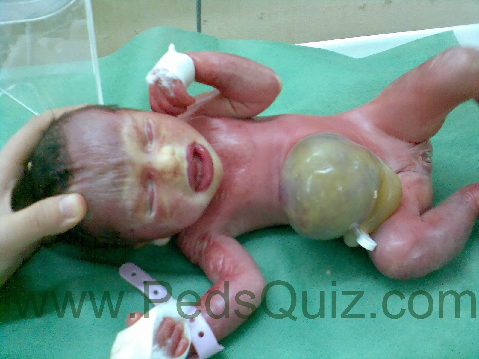 Pediatric Image Quiz A collection of interesting images