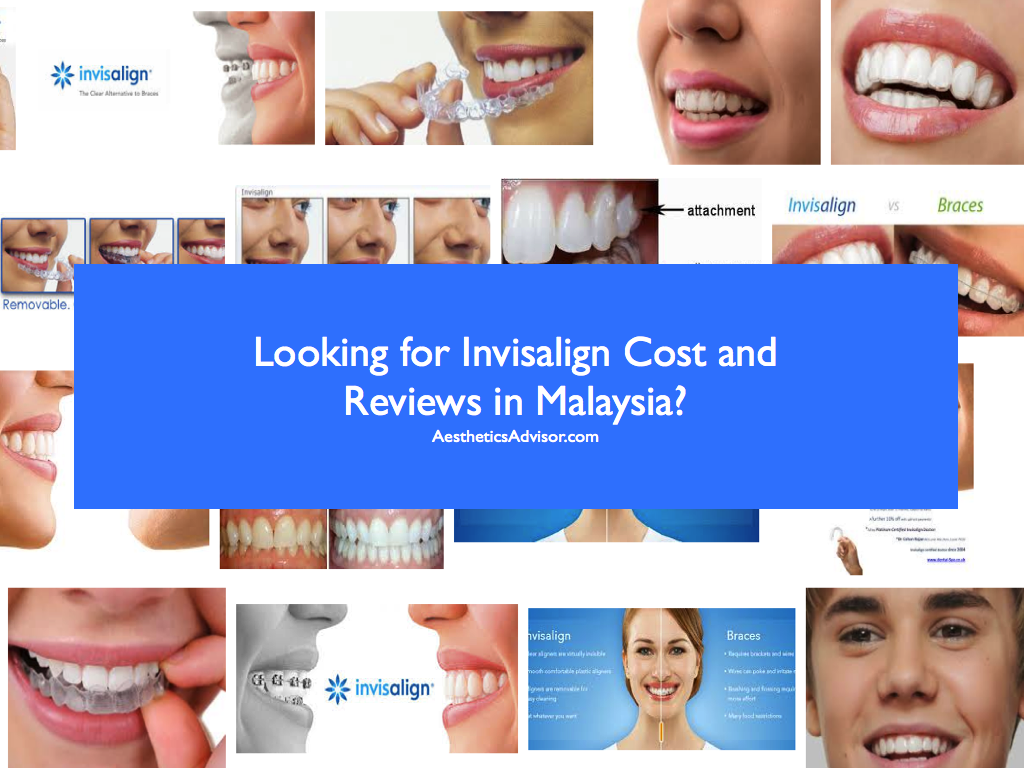 invisalign-malaysia-price-reviews-and-best-clinics-2022