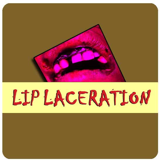 Laceration on the lip Richardson dental and craniofacial Hospitalposts