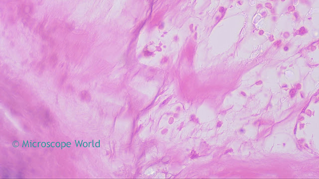 Microscopy image of heart disease captured under the microscope at 400x using a plan fluor apochromat objective lens.