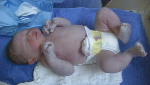 Pietro nasceu dia 28/08 de cesárea necessária...
