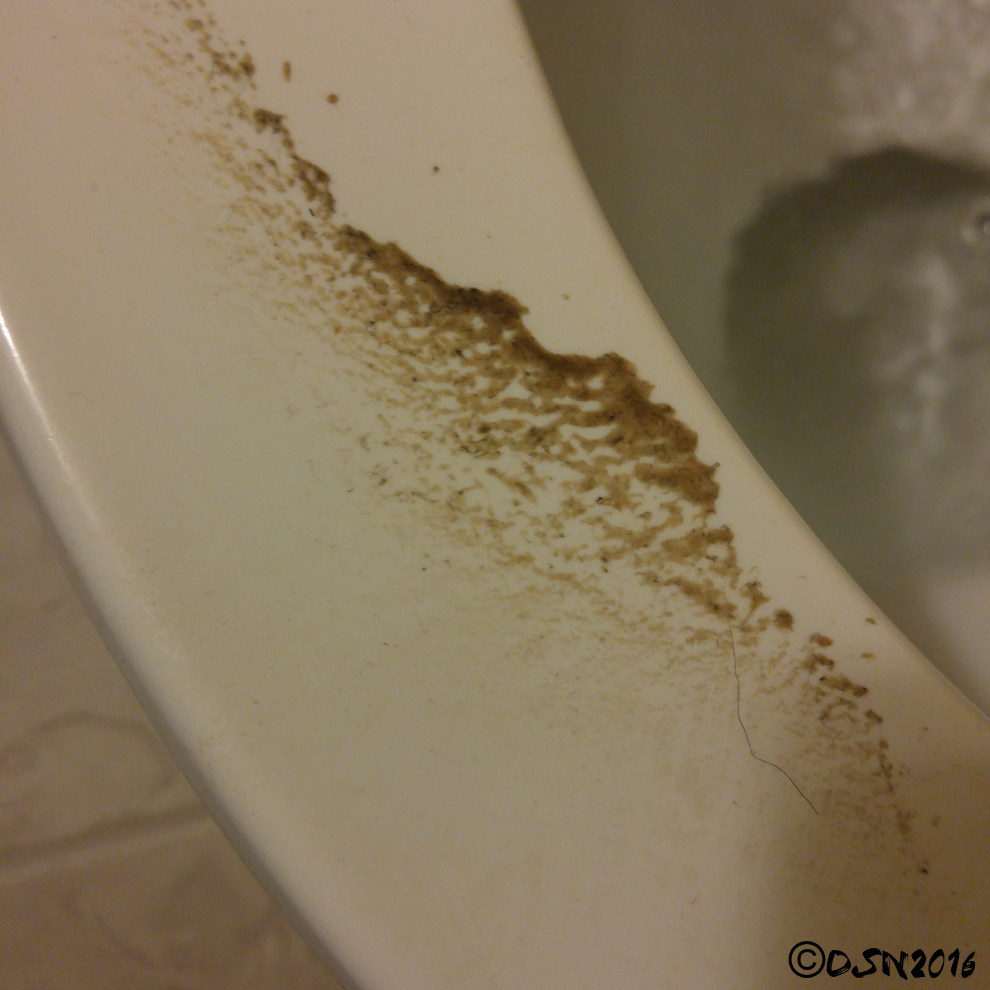 Why Do I Leave Dead Skin On The Toilet Seat wedgebeauty
