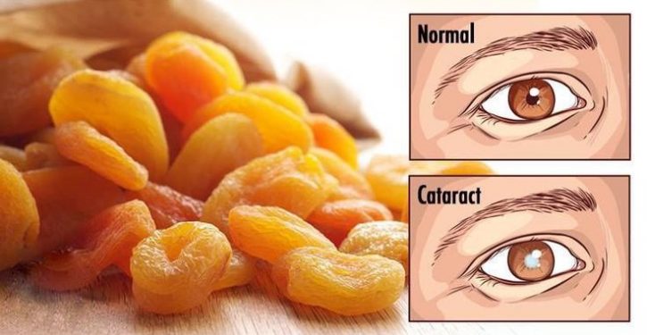 Start Eating These 18 Foods When You Notice That Your Vision Is Starting To Decline