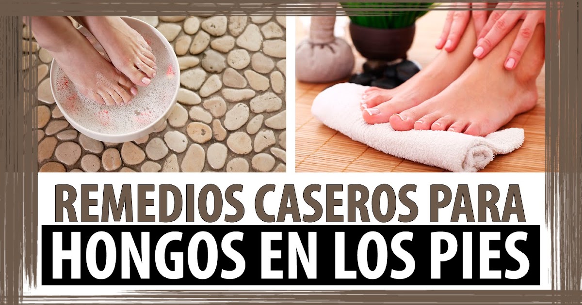 El hongo sobre las uñas el programa malyshevoy