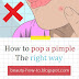 How to Pop a Pimple the Right Way