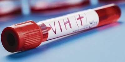 Científicos afirman que el VIH puede ser curado-TuParadaDigital