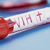 Científicos afirman que el VIH puede ser curado