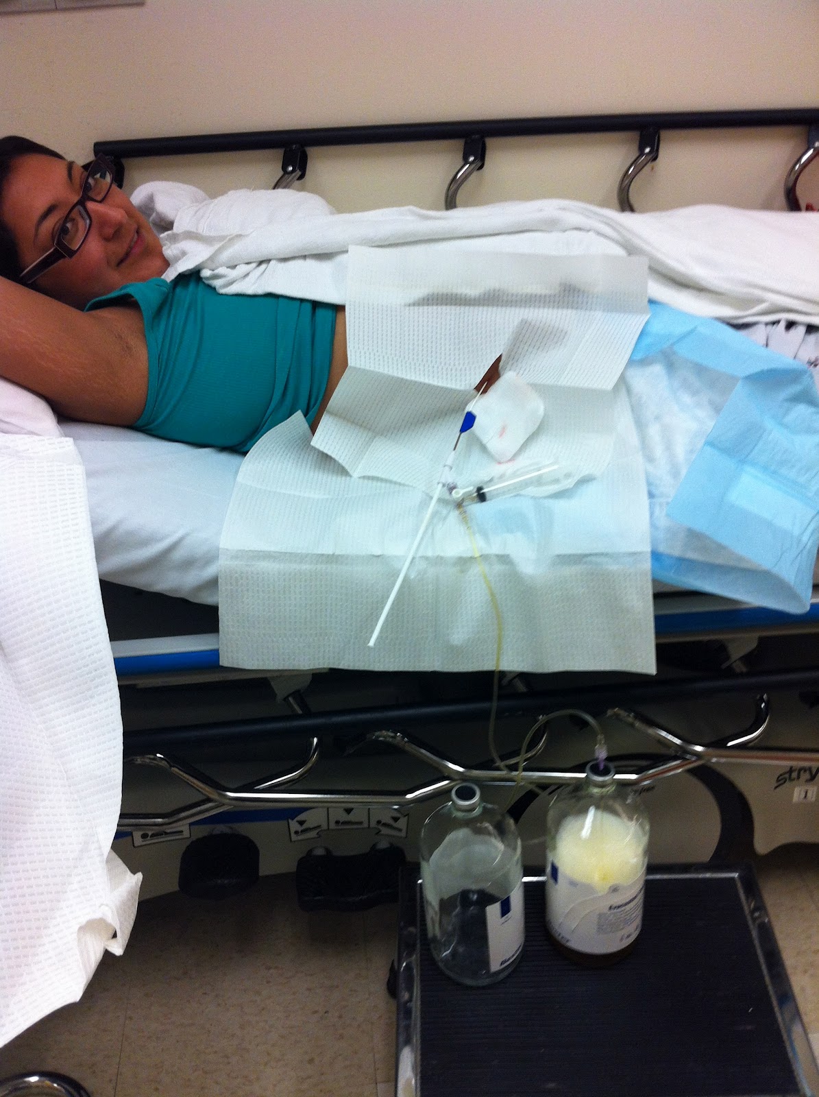 Team Marta Time for a Paracentesis...catheter to the belly!