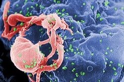 ARN de interferencia contra el SIDA