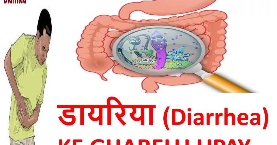डायरिया (Diarrhea) KE 30 GHARELU UPAY IN HINDI