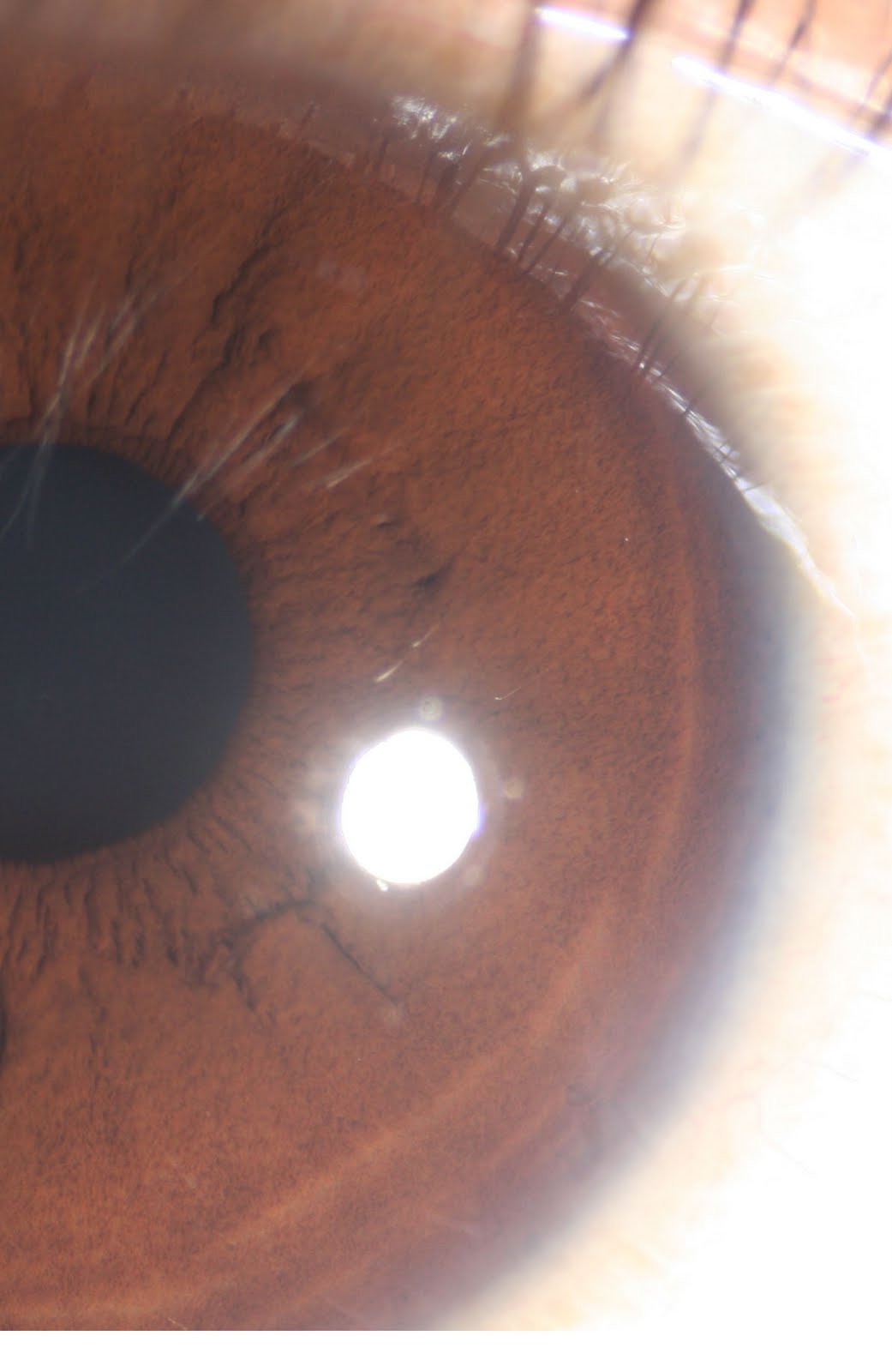 modern-multidimensional-iridology-tiger-stripes-cys
