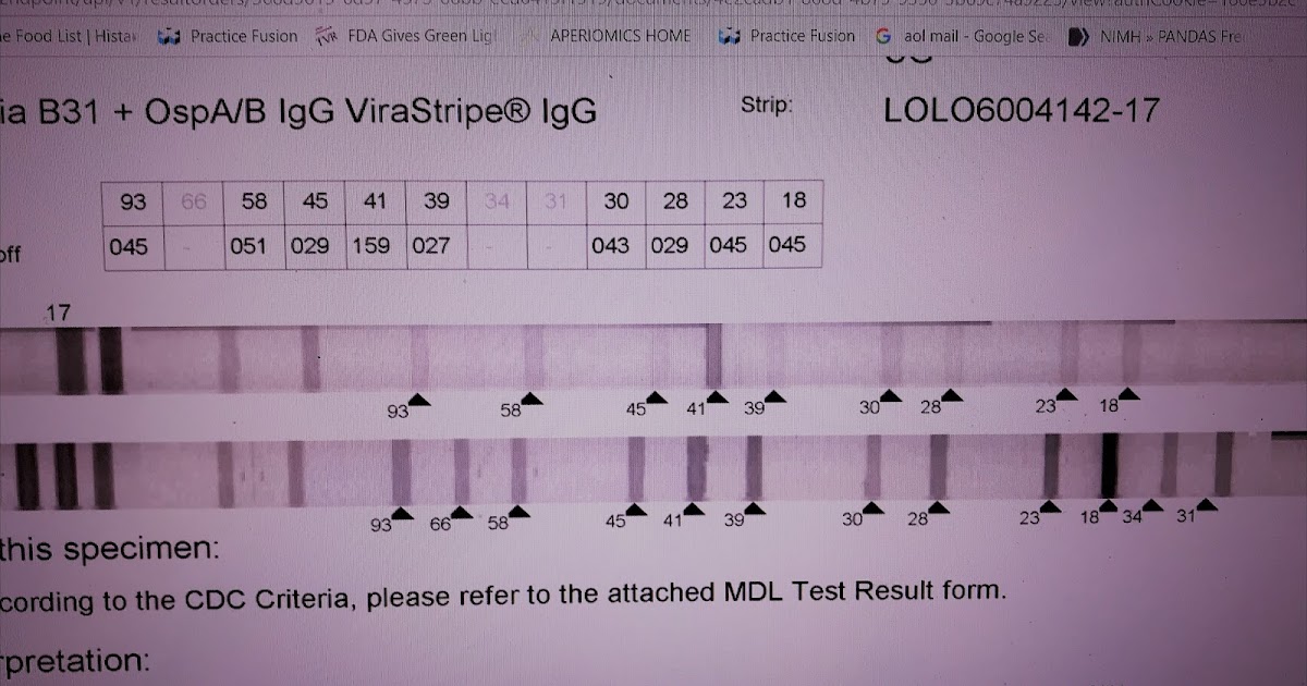 LymeMD All I got was a 41 band. All I got were IgM bands could it