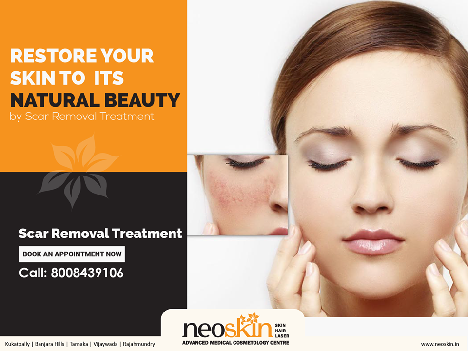 Skin Care & Cosmetology Centers in Hyderabad india. Permanent Tattoo