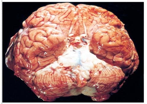 http://2.bp.blogspot.com/-gL7lo1rfUo4/VRZpMclenQI/AAAAAAAAAwU/5xWxQm1XIb8/s1600/otak-meningitis.jpg