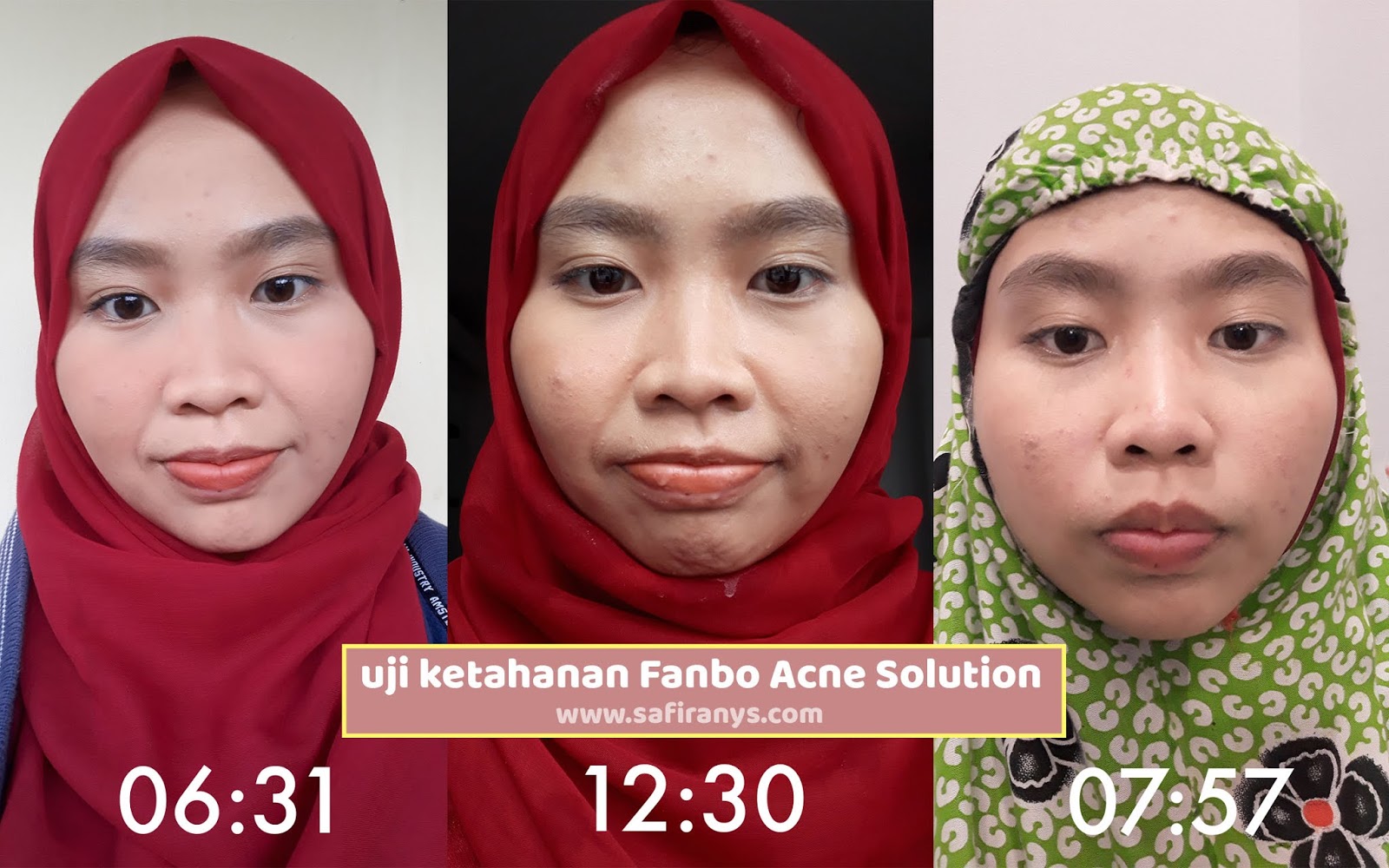 Bedak Tabur Acne Solution Fanbo