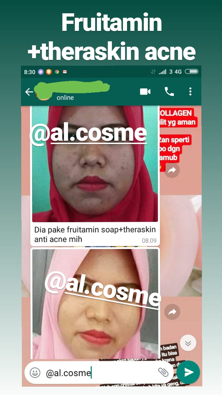 Get Frozen Collagen Testimoni Images