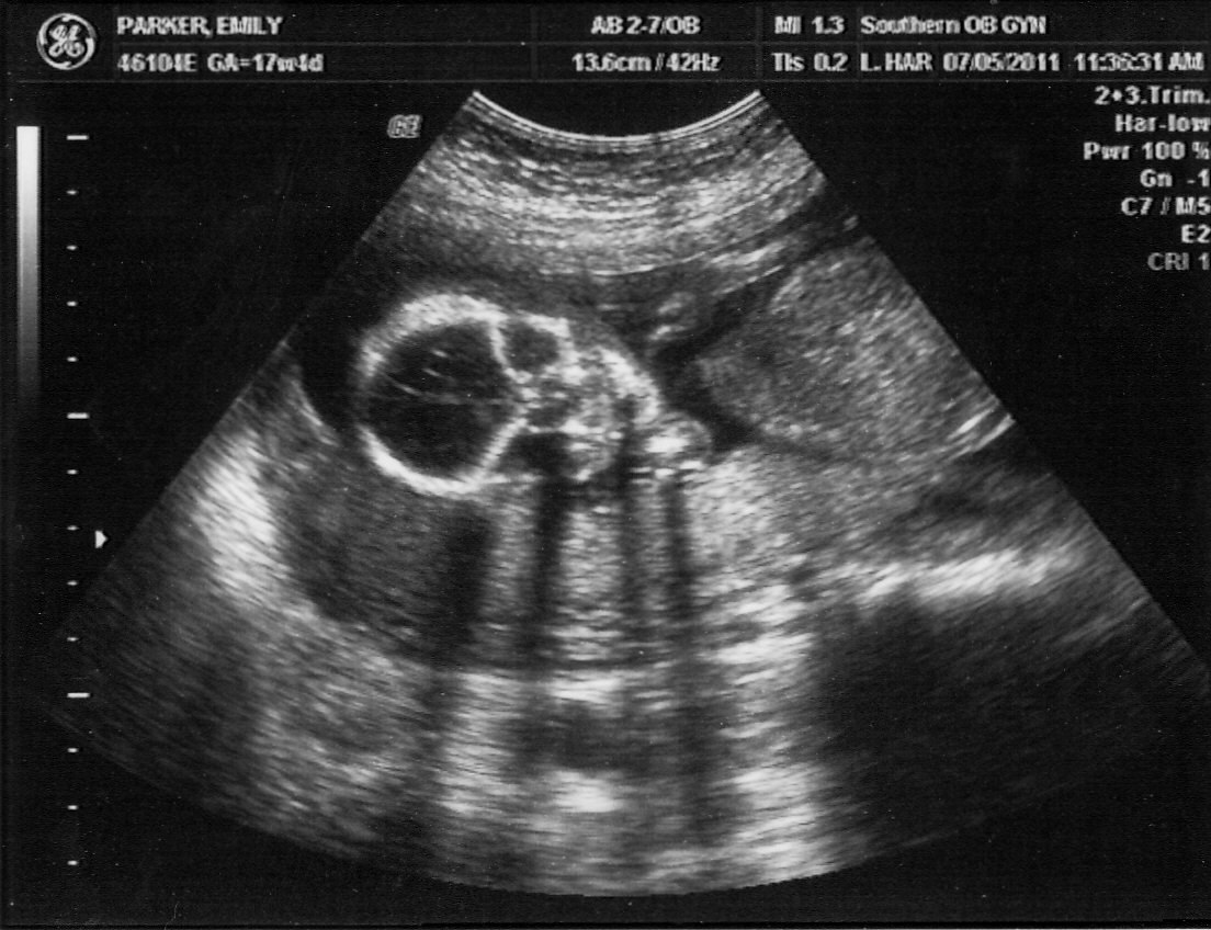Blitzen’s First Ultrasound