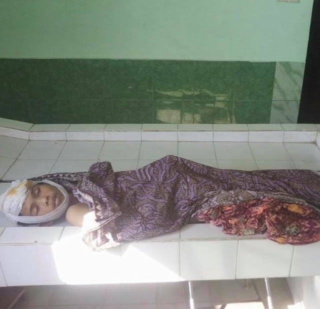 Dipaksa Ngaku Mencuri Bawang Remaja Yatim Ini Tewas Setelah Dibacok Kepalanya Dipaksa Ngaku Mencuri Bawang Remaja Yatim Ini Tewas Setelah Dibacok Kepalanya