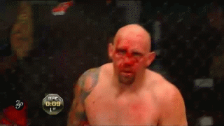 carwin-bloody-face-ufc-131-jds.gif