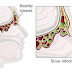 Obat Tradisional Penyakit Sinusitis Akut dan Kronis