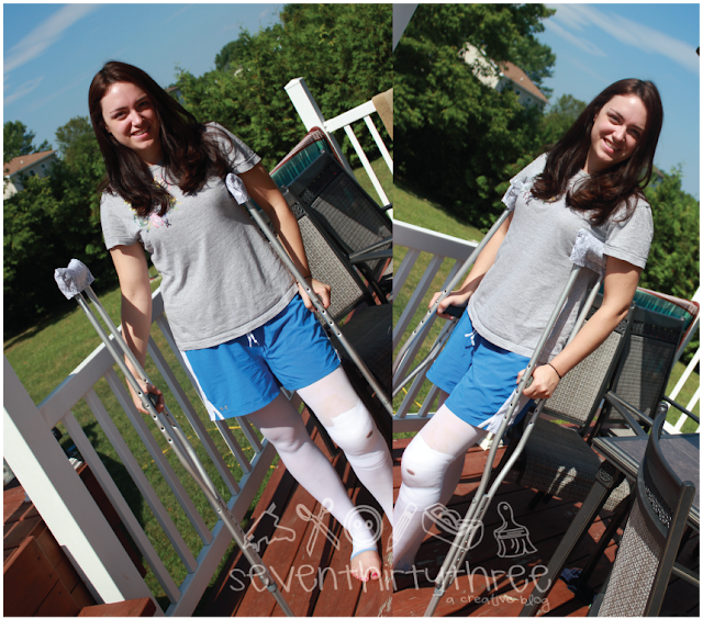 Beauty Up those Crutches Inspiration Made Simple