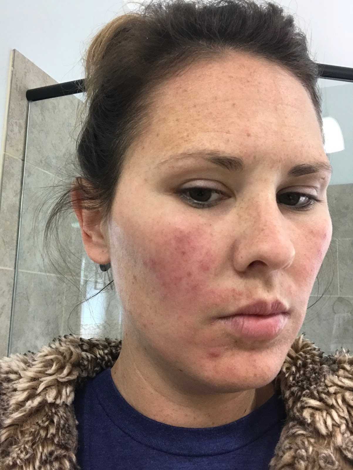 Hold the Gluten Please It's my face after all!