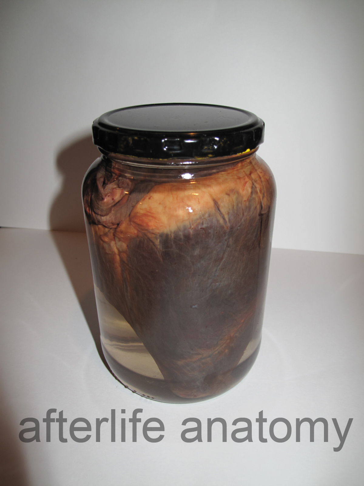 afterlife anatomy custom mount and wet specimens!