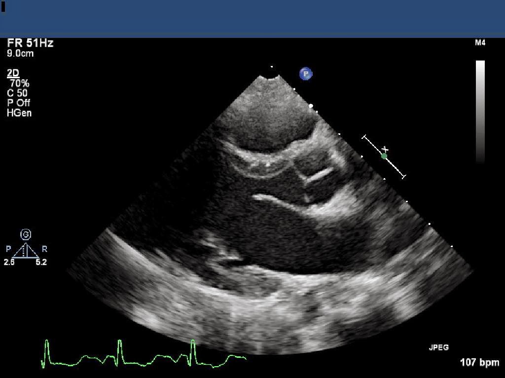 stuff jo knows working women lindsay a cardiac sonographer