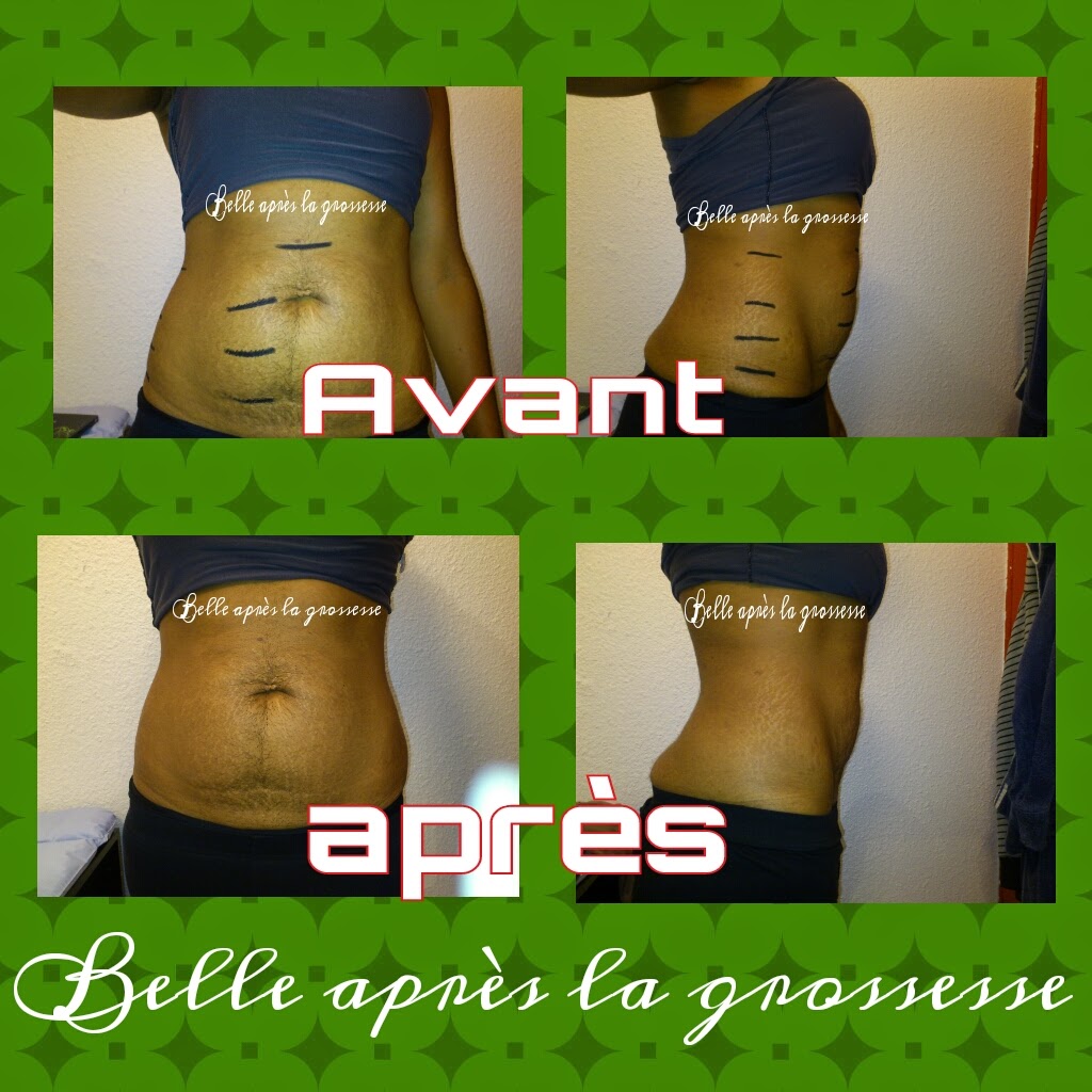 Belle après la grossesse le wrap minceur It works sa fonctionne